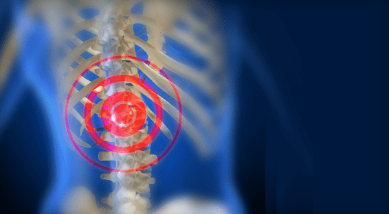 Analyzing Artificial Cervical Disc Replacement