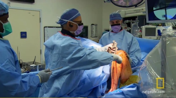 Limb Lengthening – Video Highlight