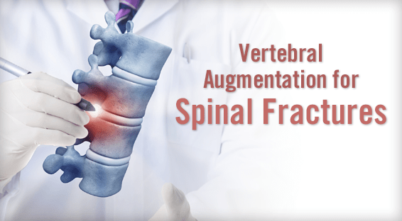 Vertebral Augmentation for Spinal Fractures