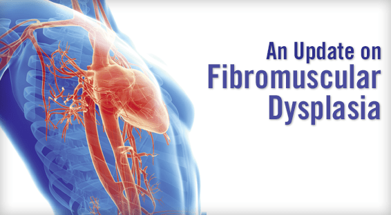 An Update on Fibromuscular Dysplasia