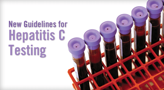 New Guidelines for Hepatitis C Testing