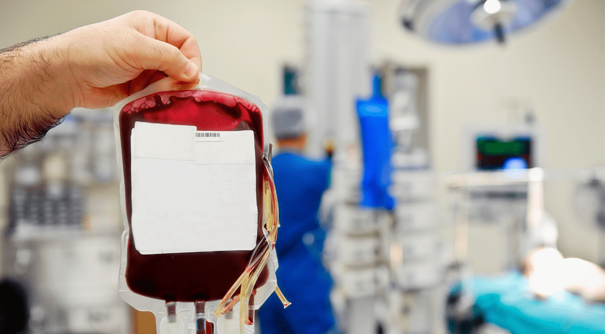 Lower-Extremity Amputation & RBC Transfusion