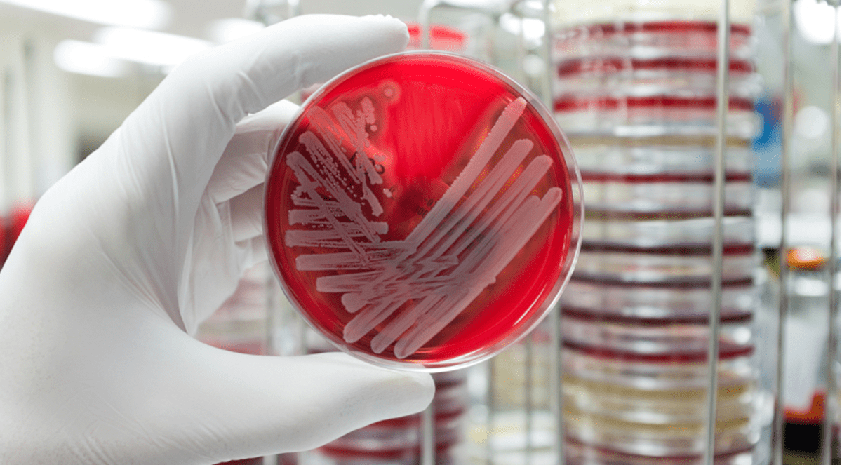 Increasing Susceptibility of Staphylococcus Aureus in the United States