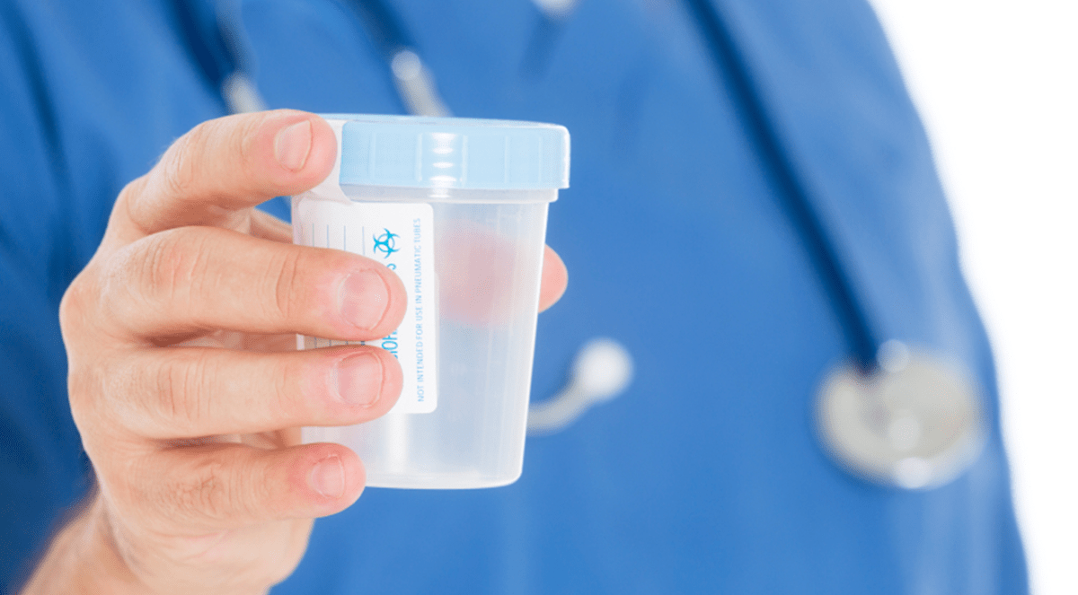 Urine Drug Tests: Effective for Uncovering Opioid Misuse But Easy To Cheat On