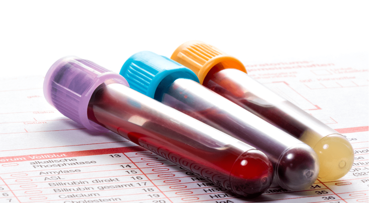 Blood Test That Measures Protein Levels Can Determine Which Medication to Take to Overcome Depression