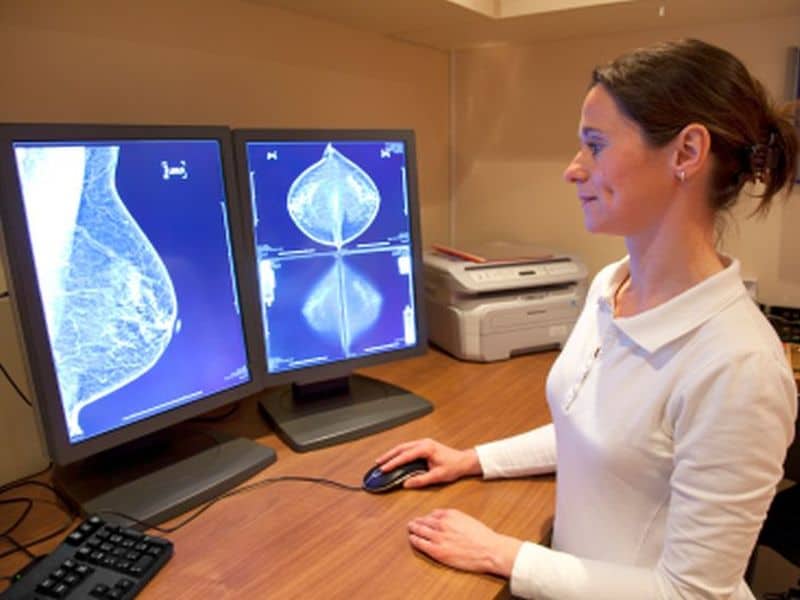 Guidelines for Managing Breast Cancer Survivors