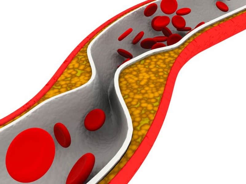 Cholesterol Treatment Trends