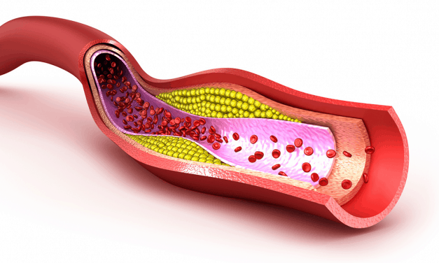 High Levels of ‘Good’ Cholesterol Linked to Excessive Mortality