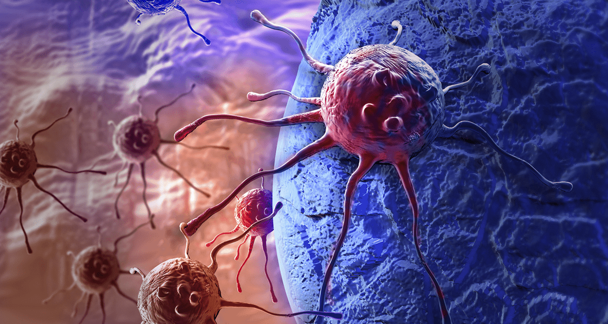 Drug Suppresses Spread of Breast Cancer Caused by Stem-Like Cells