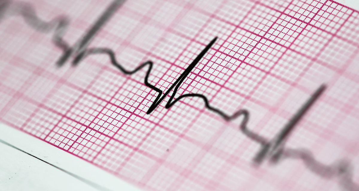 Assessing Oral Anticoagulant Prescription for Atrial Fibrillation