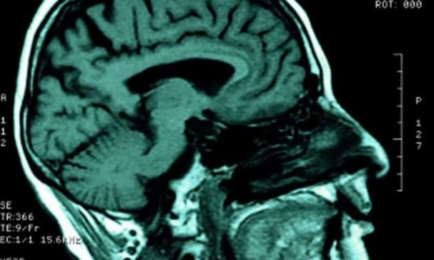 A Young Person Having Abnormal Cognitive Status and Tuberculous Meningitis