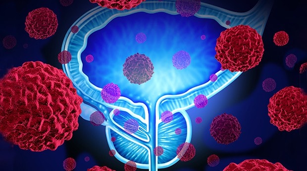 Newly Discovered microRNA Regulates Mobility of Tumor Cells