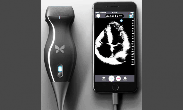 Can a handheld ultrasound replace your doctor?