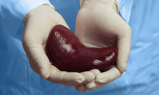 Simultaneous Nephrectomy Safe During Kidney Transplant for ADPKD