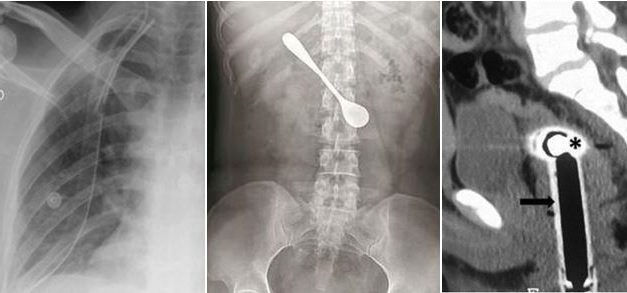 Three unusual cases