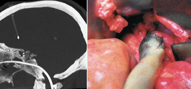 Unusual Cases Part 2