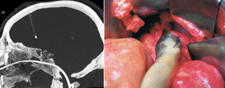 Unusual Cases Part 2