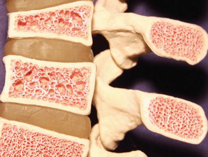 Lumbar Puncture Guidance