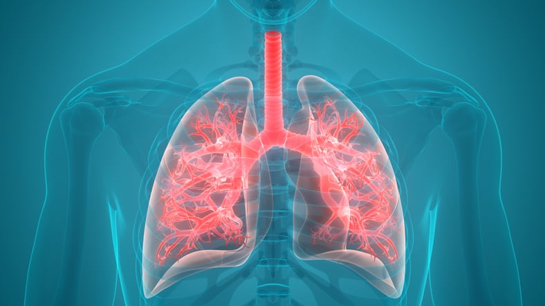 Curative-Intent Treatment Improves Survival in Early NSCLC Regardless of Race