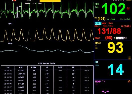 Update: Mortality rate of COVID-19 patients on ventilators