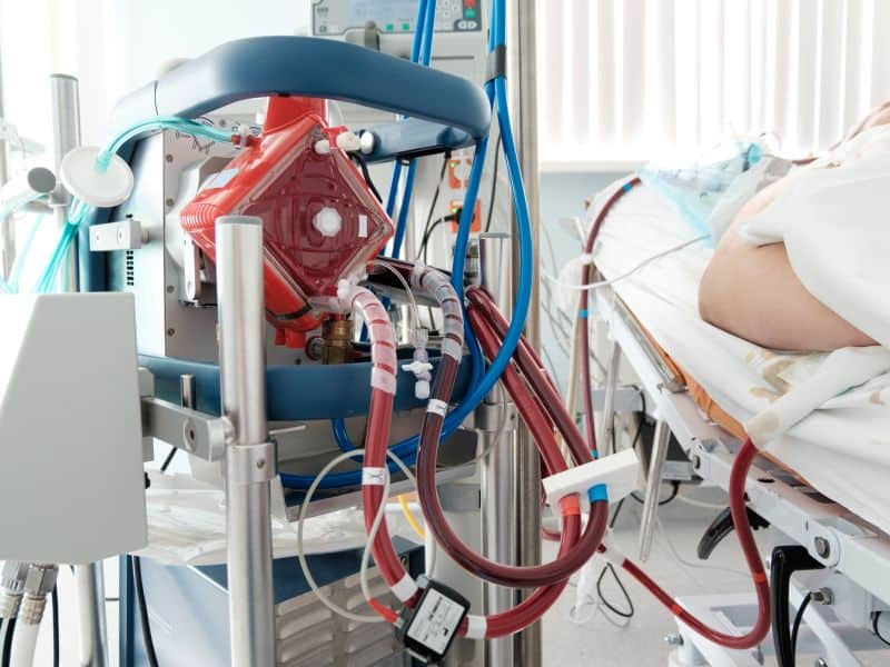 Mortality Below 40 Percent for COVID-19 Patients Put on ECMO