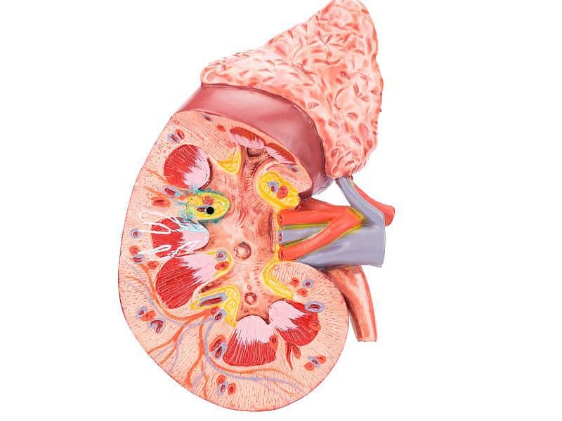 Kidney Duct Carcinoma Collection