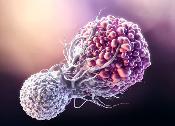 The preoperative platelet distribution width: A predictive factor of the prognosis in patients with non-small cell lung cancer.