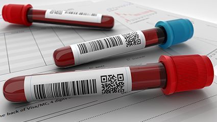 Decline in SARS-CoV-2 Antibody Response Seen Over 60 Days