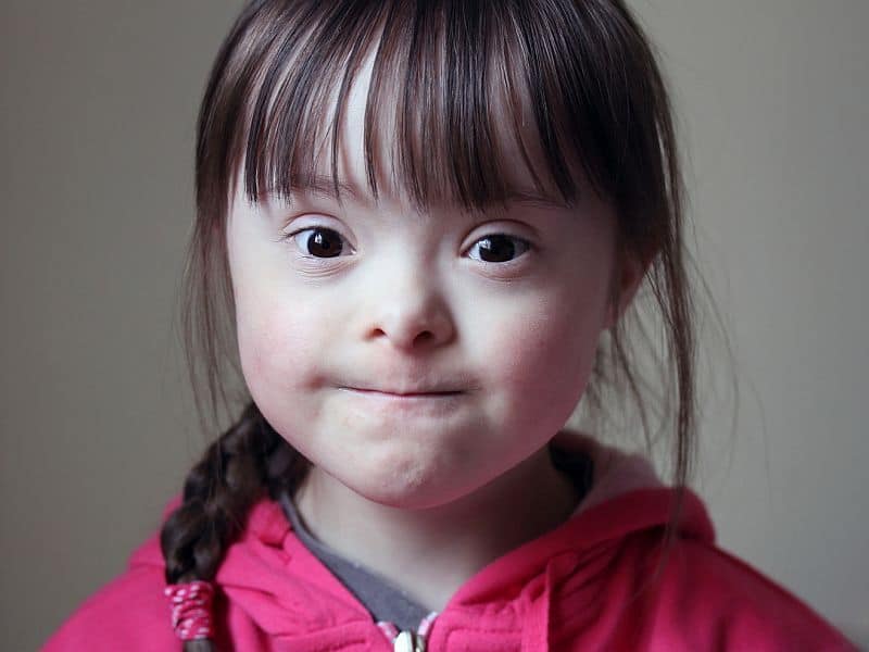 Children With Down Syndrome at Higher Risk for Leukemia