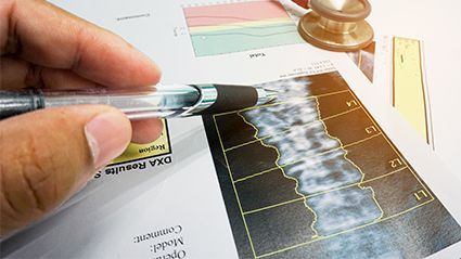 Osteoporosis Prevalence at Femur Neck, Lumbar Spine 12.3 Percent