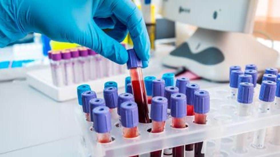 Study Clinically Validates Multi-Cancer Early Detection Test