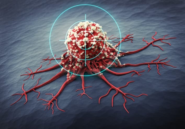 Identification three LncRNA prognostic signature of ovarian cancer based on genome-wide copy number variation.