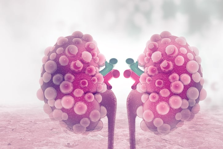 Profile of Urine Exosomes microRNAs and Their Contribution to Diabetic Kidney Disease