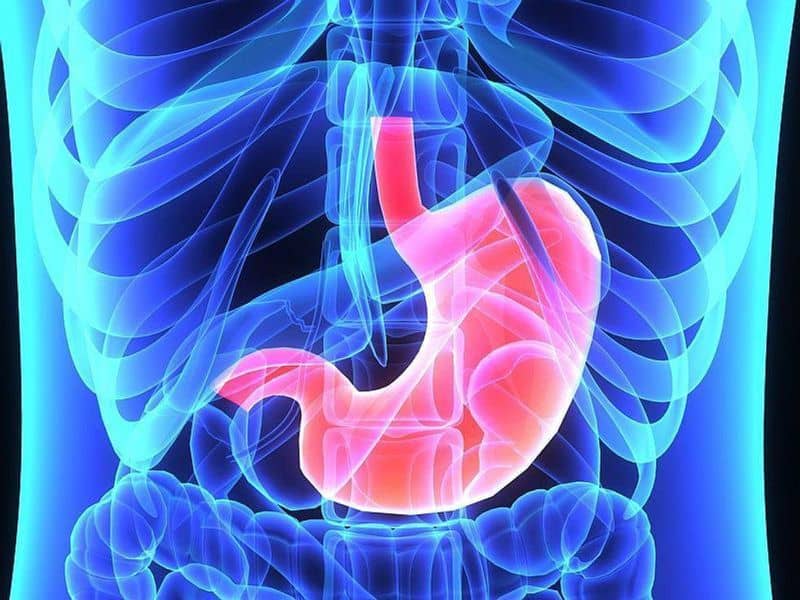 Robotic Gastrectomy for Gastric Cancer Does Not Cut Postop Infections