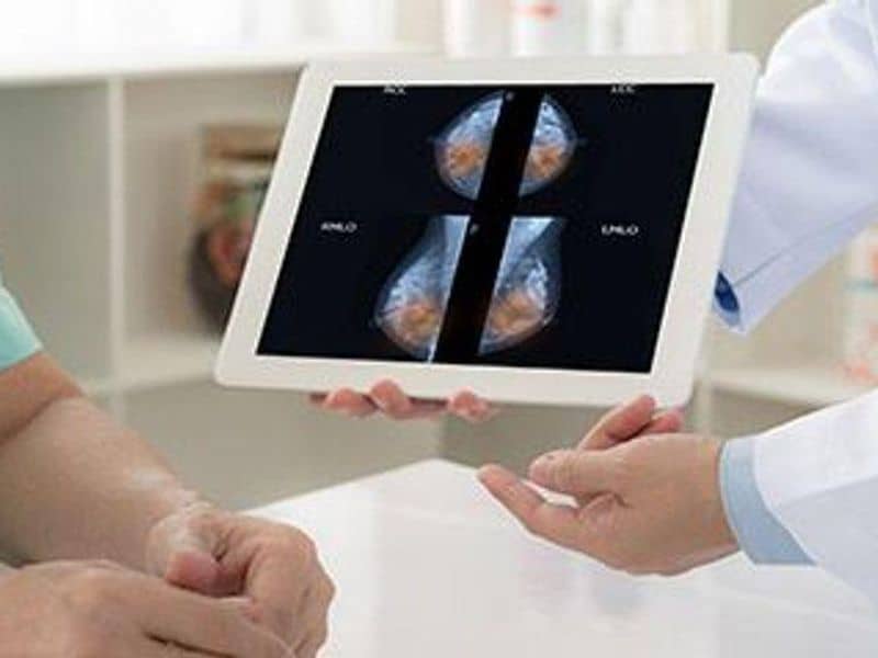 RSNA: Changes on Breast MRI Suggest Systemic Effects of LNG-IUD Use