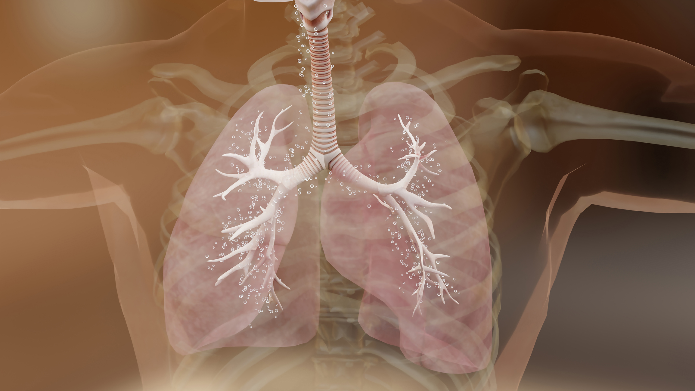 Social Determinants of Health Effect Housing-Related Asthma