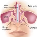 Capecitabine maintenance therapy for metastatic nasopharyngeal carcinoma improves progression-free survival