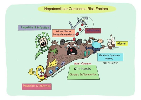 Hepatocellular Carcinoma Pathways