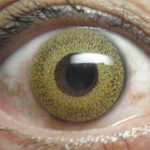 Faricimab may improve visual acuity in patients with diabetic macular edema