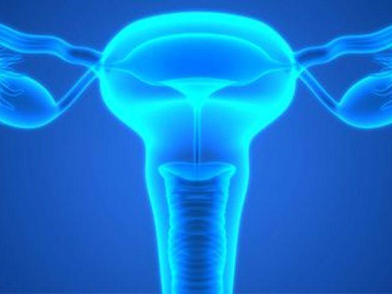 Radiographic Findings Described for Salpingography, Recanalization