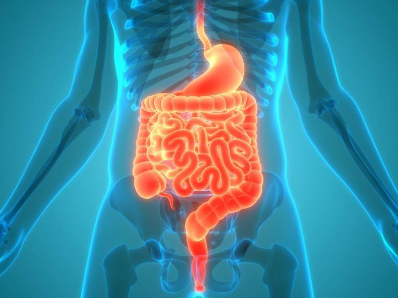 MRI Index Can Predict Postop Recurrence in Crohn Disease