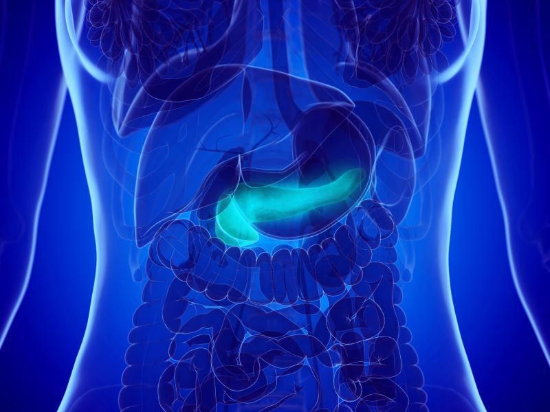 Neoadjuvant mFOLFIRINOX Studied for Borderline Resectable PDAC