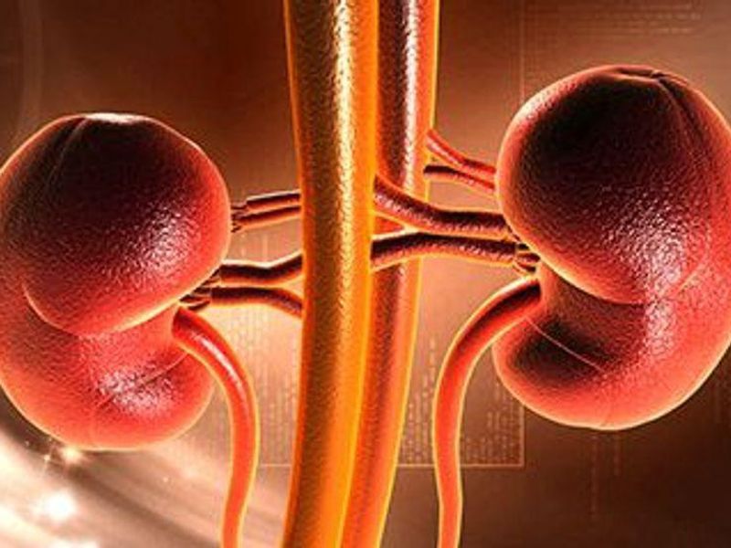 Native Nephrectomy in the Workup for Kidney Transplantation in Patients With ADPKD