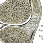 Vamorolone associated with loss of bone morbidities compared with prednisone in boys with Duchenne muscular dystrophy