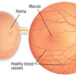 Artificial intelligence-aided analysis of retinal imaging may predict cardiovascular mortality