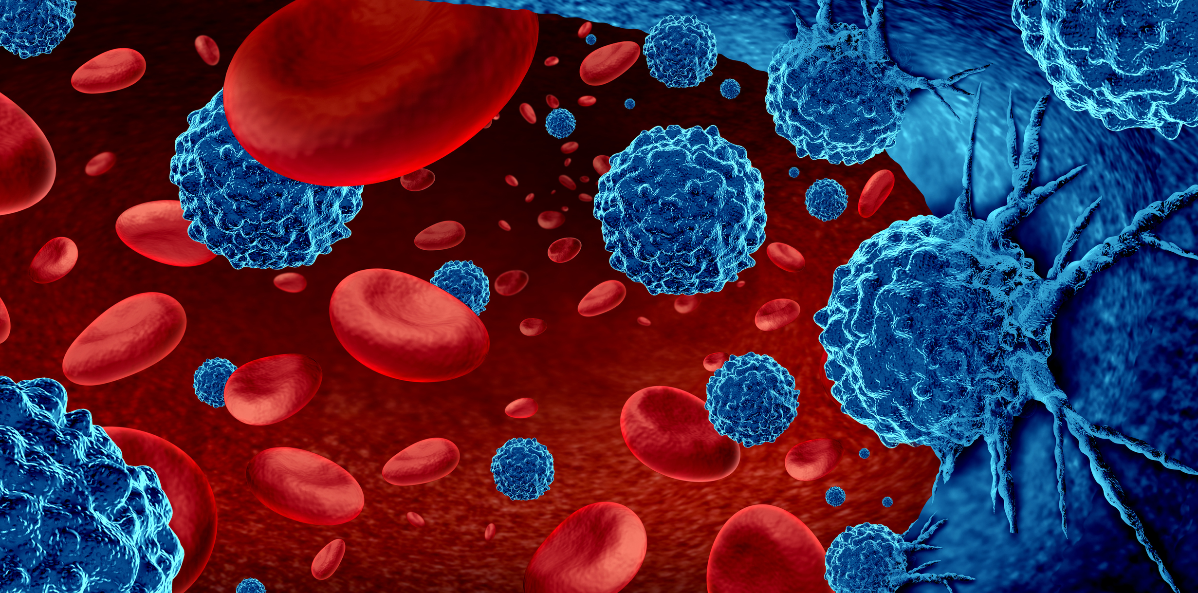 Serum exosomal miR-378 upregulation is associated with poor prognosis in non-small-cell lung cancer patients.