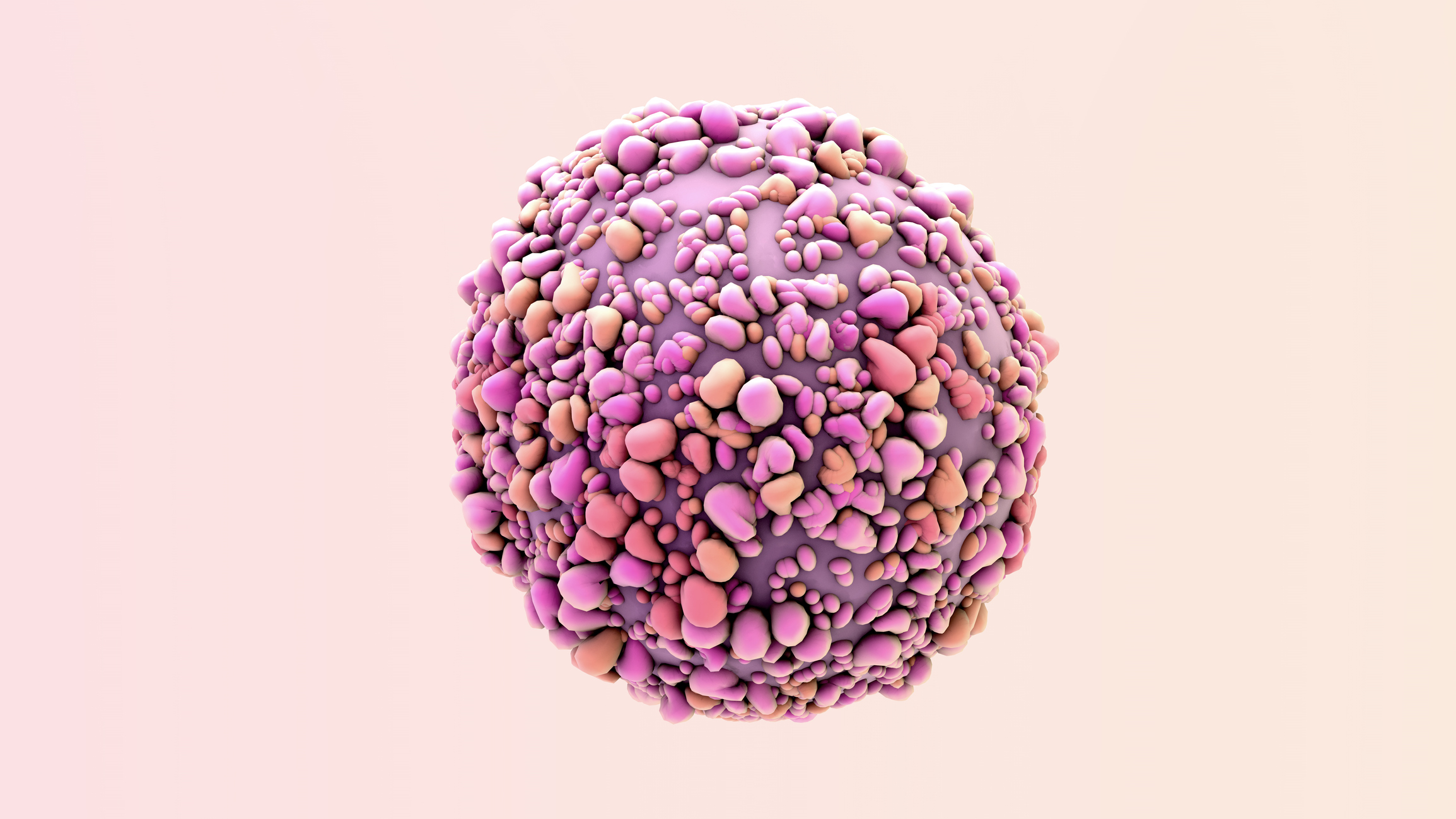 Circular RNA PVT1 enhances cell proliferation but inhibits apoptosis through sponging microRNA-149 in epithelial ovarian cancer.