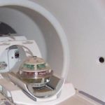 Positive prostate MRI and targeted biopsy reduce the detection of clinically insignificant prostate cancer