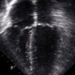 Comparison of simulation versus didactic-based instruction for transesophageal echocardiography teaching: the SIMULATOR randomized clinical trial