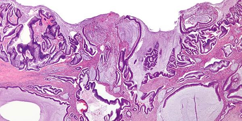 Faecal haemoglobin concentrations associated with mortality and cause of death in colorectal cancer screening